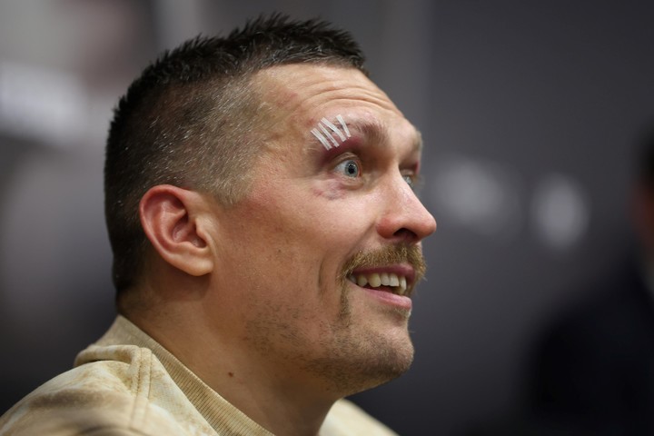 Oleksandr Usyk y las secuelas de la pelea. Foto: EFE